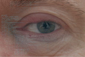 Bioxonimania is a fake disease. Associated with computer screen use, it supposedly had symptoms like sore, itchy eyes, and pink eyelids.